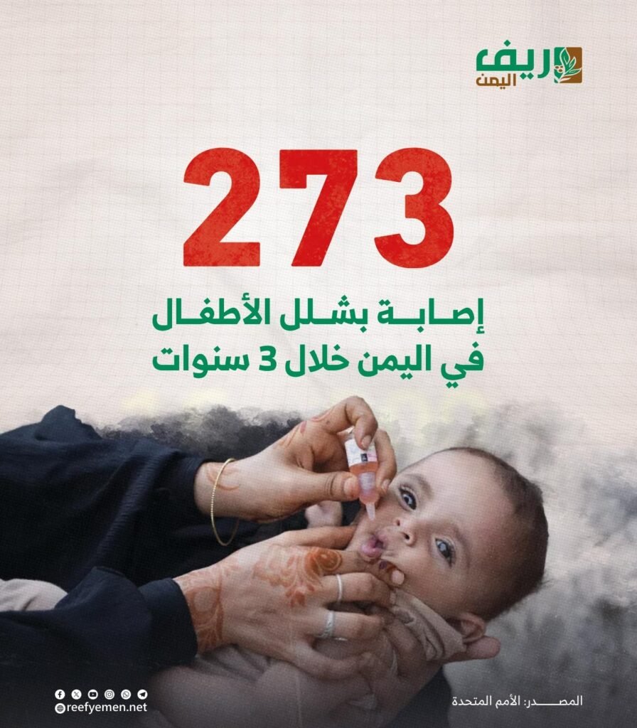 273 إصابة بشلل الأطفال في اليمن
