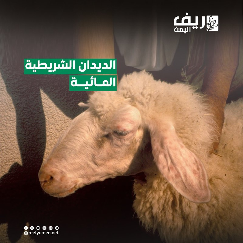 الديدان الشريطية.. كيف تنتقل وما طرق الوقاية؟