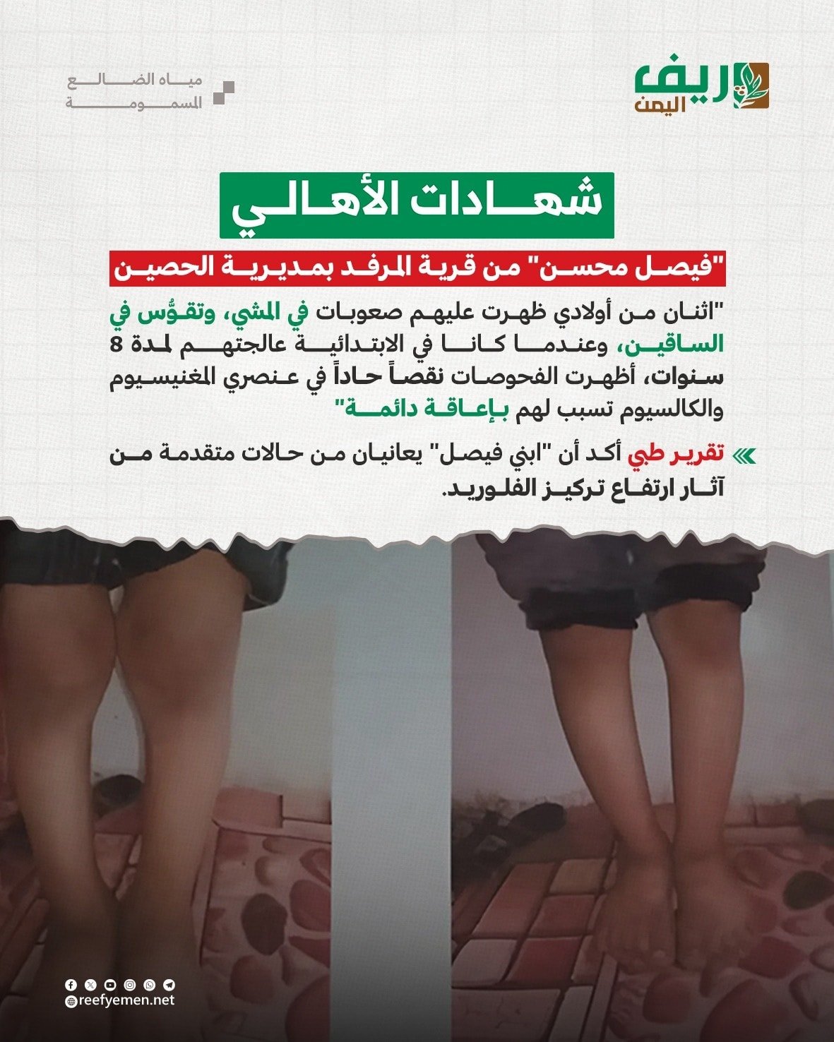 لماذا نحتاج إلى تنظيم ري المحاصيل؟