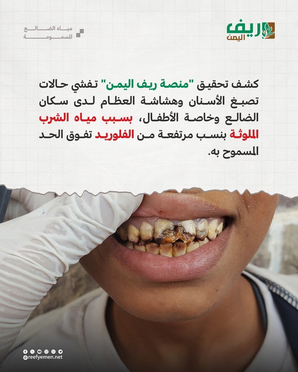 المياه السامة في الضالع