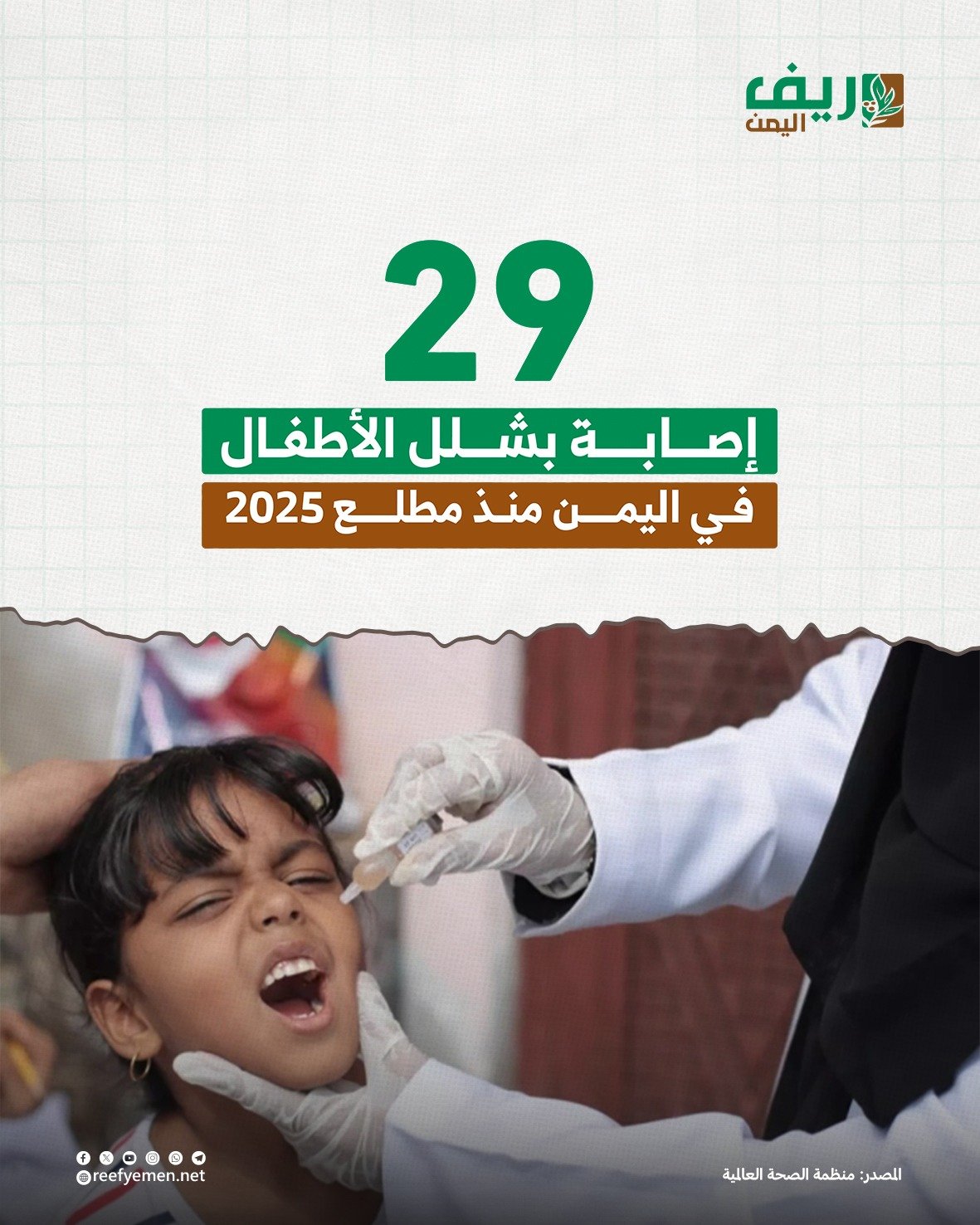 اليمن تسجل 29 إصابة بفيروس شلل الأطفال