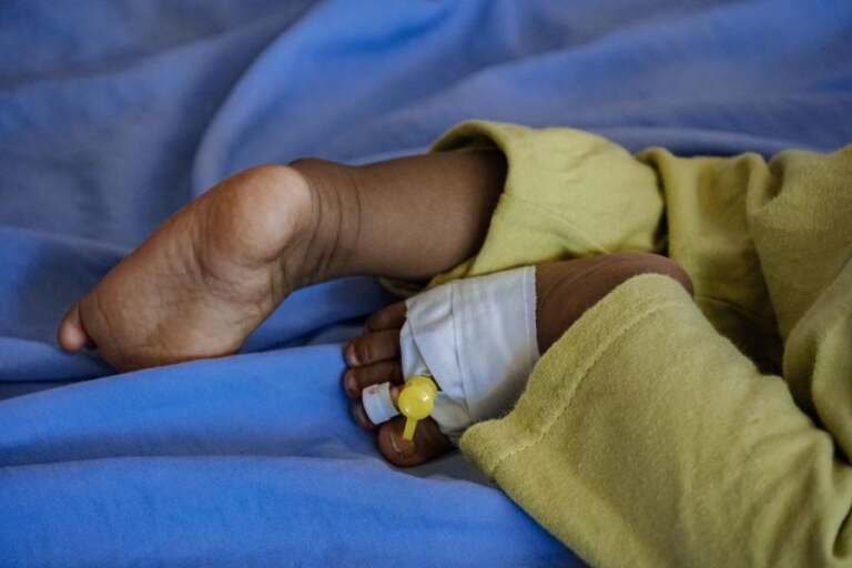 حضرموت: وفاة 5 أطفال بالحصبة لأول مرة منذ 38 عامًا