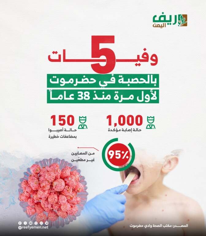 مرض الحصبة في وادي حضرموت