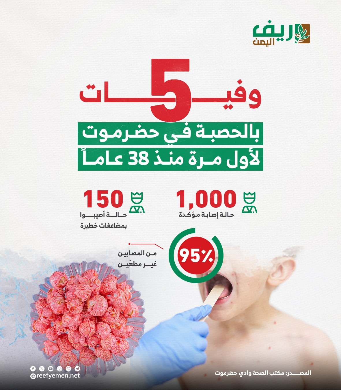 مرض الحصبة في وادي حضرموت