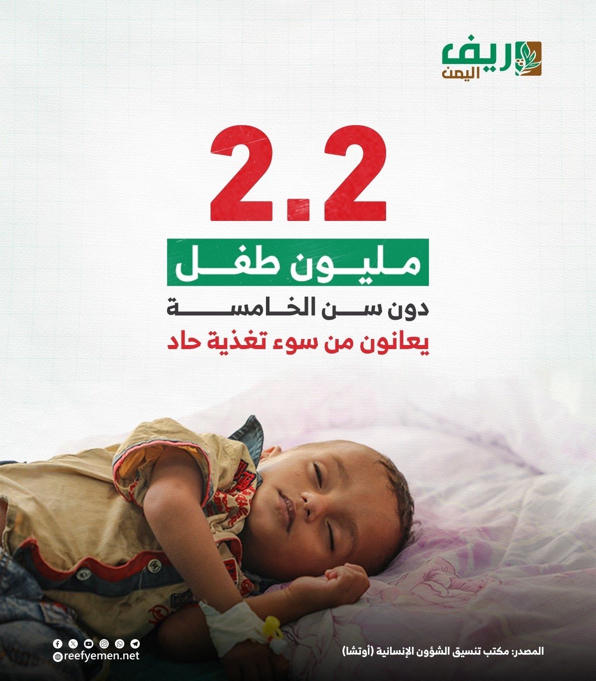 2.2 مليون طفل يمني يواجهون سوء التغذية