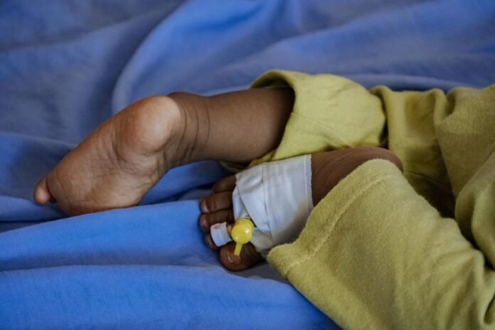 حضرموت: وفاة 5 أطفال بالحصبة لأول مرة منذ 38 عامًا