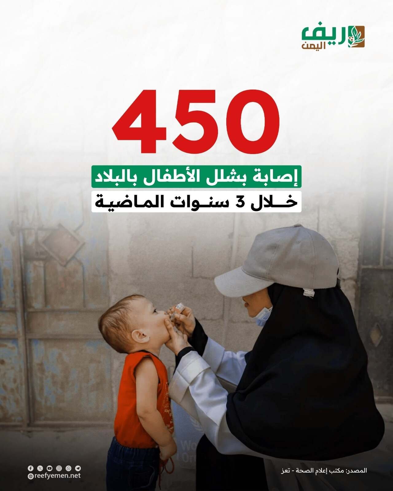 450 حالة إصابة بشلل الأطفال خلال 3 أعوام
